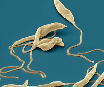 Image: Colored scanning electron micrograph (SEM) of several Leishmania parasitic protozoans (Photo courtesy of the Eye of Science).